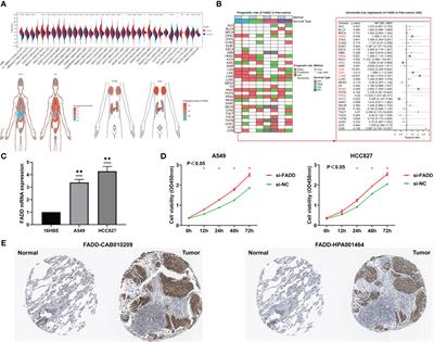 Upregulated FADD is associated with poor prognosis, immune exhaustion, tumor malignancy, and immunotherapy resistance in patients with lung adenocarcinoma